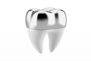 A photo of a tooth with a silver dental crown.