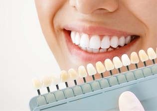 Cosmetic Veneers