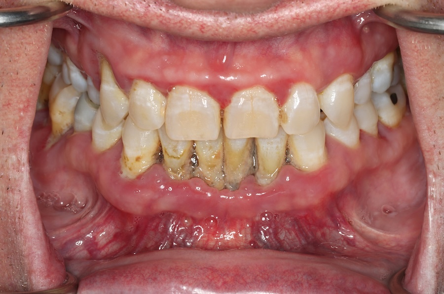 Before