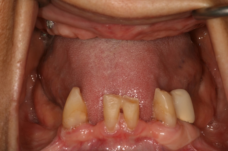 Before