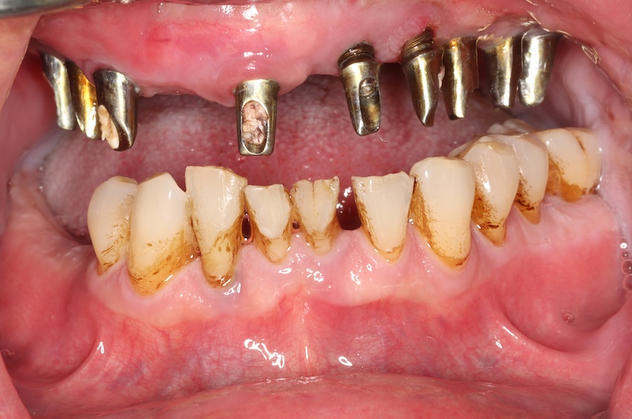Before