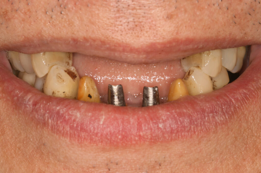 bna-sample