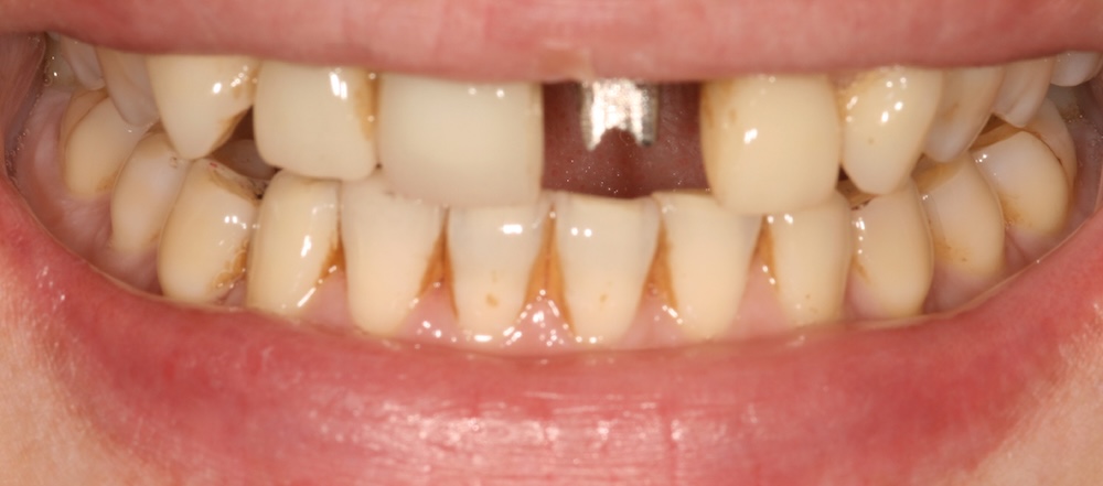 bna-sample